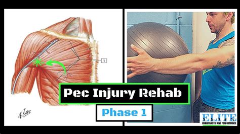 pectoralis minor tear test|pectoral tear recovery time.